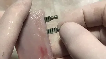 Preparazione Rex PiezoImplant