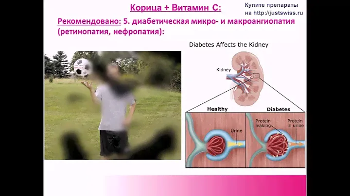 4  Швейцарские препараты для здоровья Юст Just и Morga Biorex
